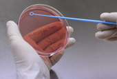 Científicos coreanos utilizan sonda de ADN para la detección de bacteria de la disentería