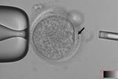 Por primera vez se obtienen por clonación células del tronco embriónico con células adultas