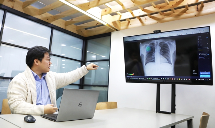 El director general de Lunit, Brandon B. Suh, presenta el Lunit INSIGHT, el softwear diagnóstico para radiografía de tórax en la sede de su empresa en Seúl, el 28 de diciembre. Una anomalía se indica con un color diferente. | Kim Sunjoo