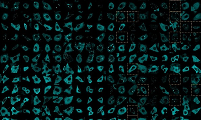 Unos investigadores coreanos descubren el mecanismo del movimiento de las células cancerígenas