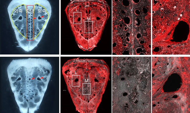 Unos investigadores coreanos descubren cómo regenerar el drenaje cerebral disminuido por la edad